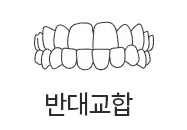 반대교합